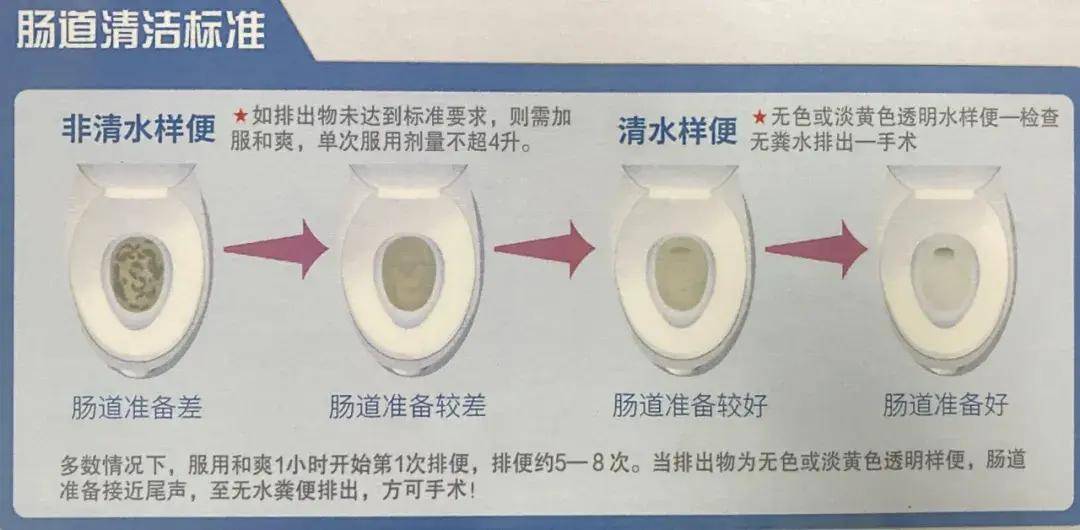二,肠镜检查前的肠道准备不可以吃粗纤维,易染色,易产气,带籽的食物