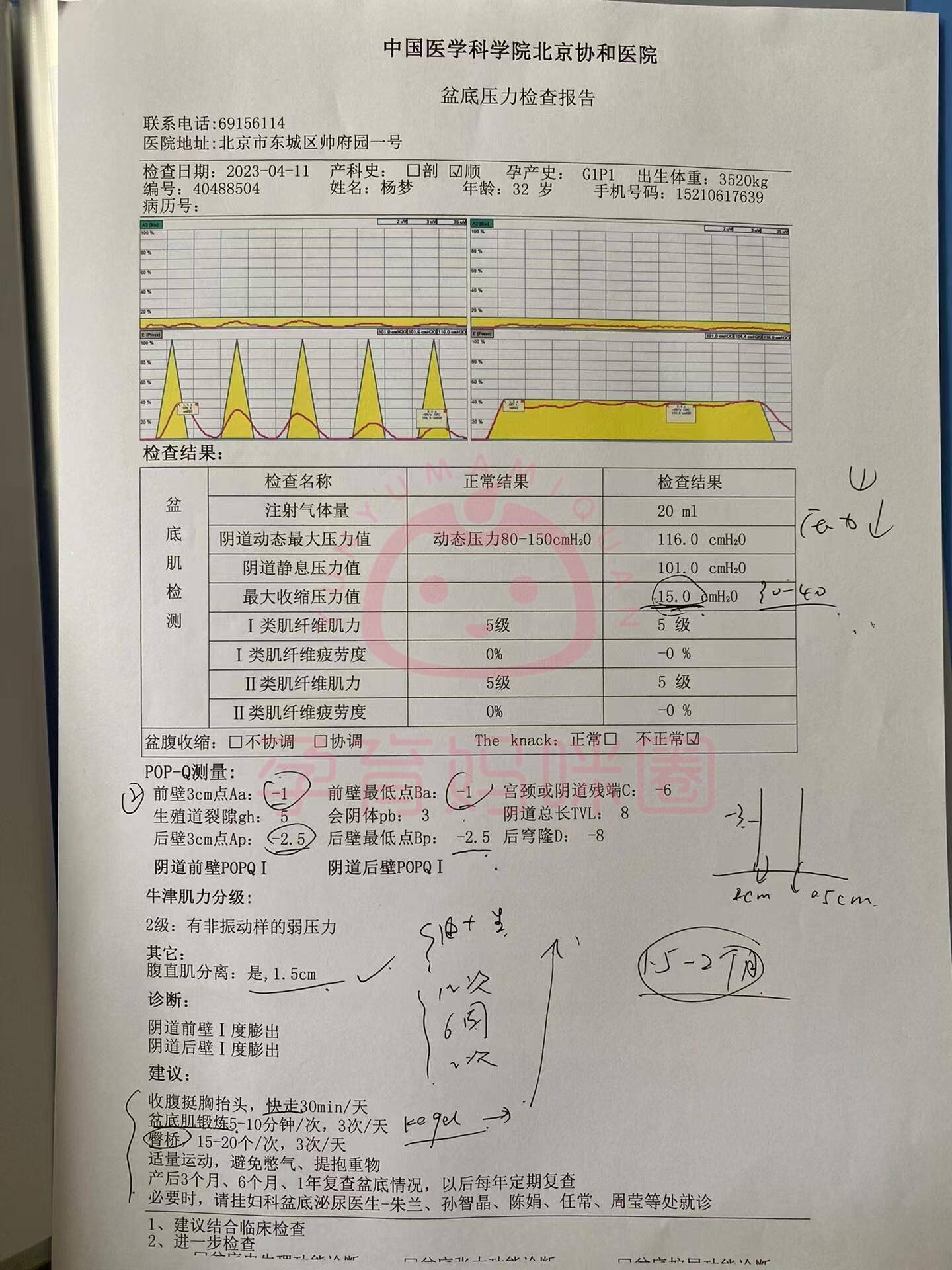 北京协和医院妇科挂号(北京协和医院妇科挂号攻略)