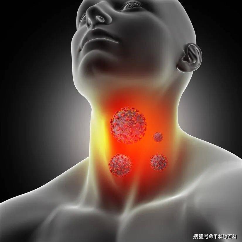 武汉甲康医院杨育峰教授科普:不少人查出甲状腺问题,是熬夜,压力大