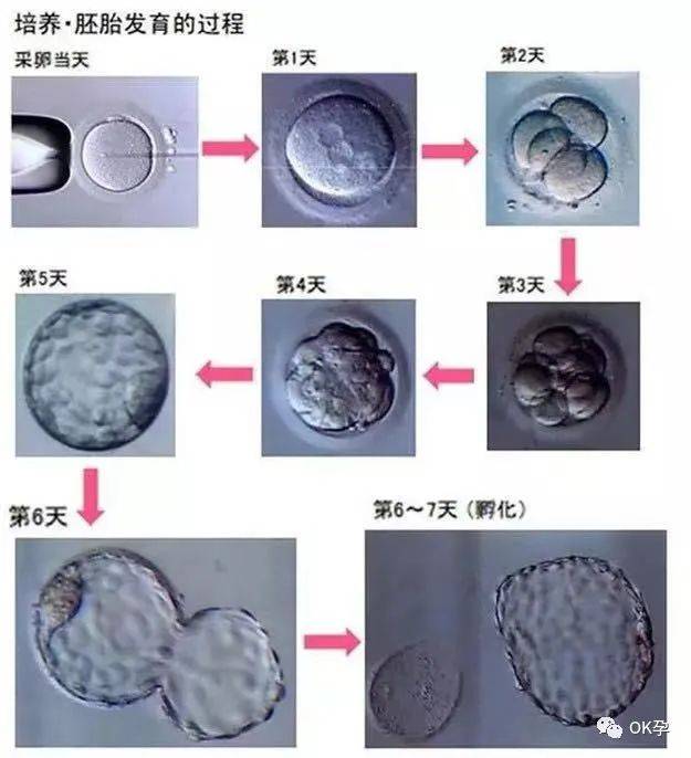 怎样知道孕囊掉了图片