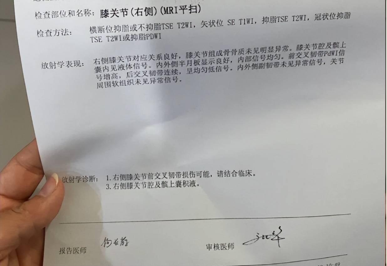 女60岁膝盖内里
疼痛挂什么科（女60岁膝盖内里
疼痛挂什么科查抄
）