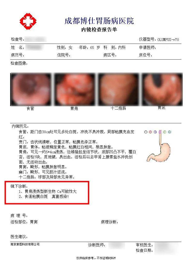 胃疼病例的照片图片