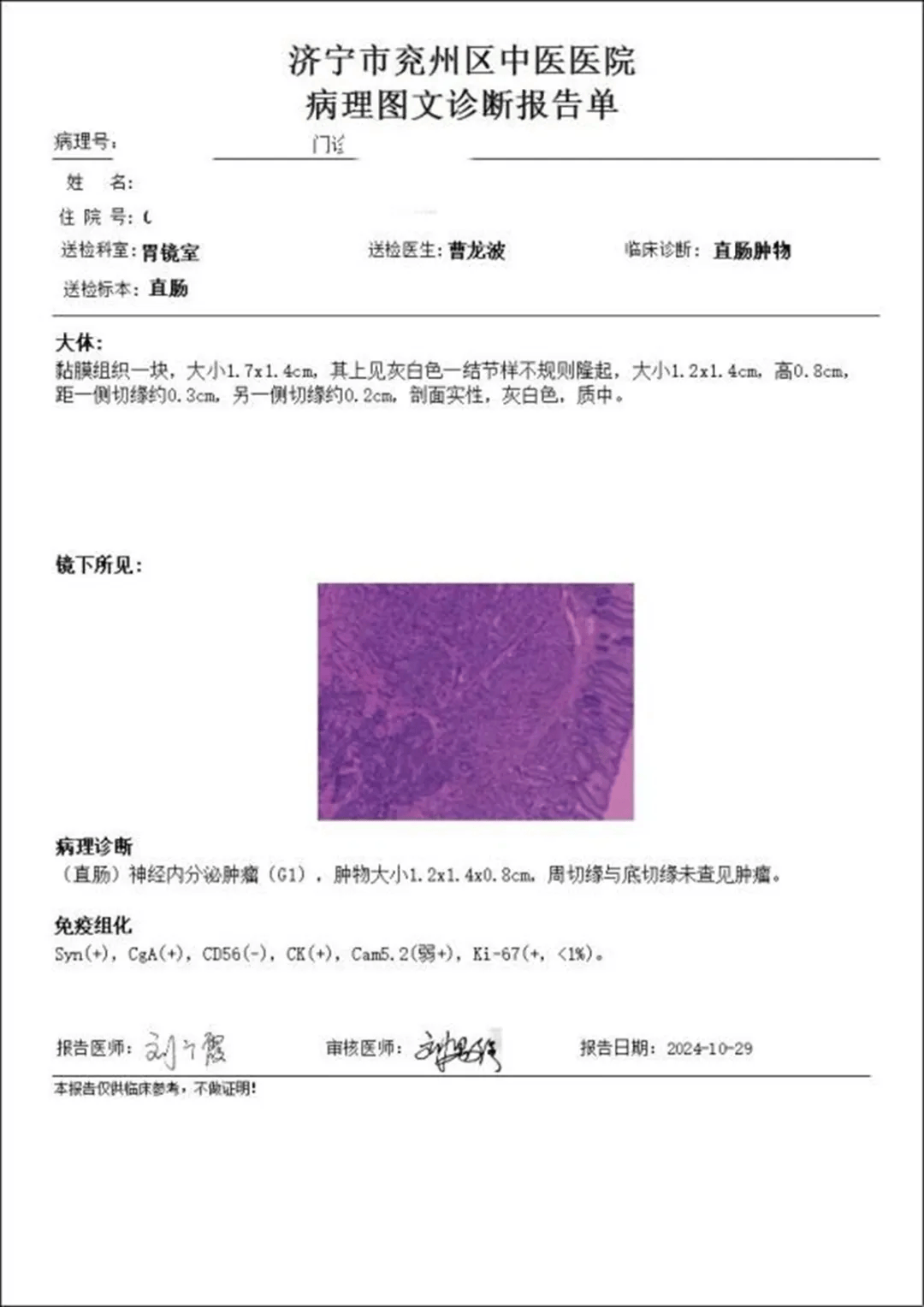 胃镜室成功完成直肠esd治疗直肠神经内分泌肿瘤1例_患者_诊断_检查
