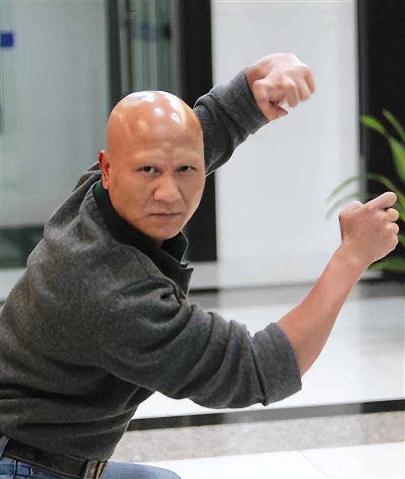 17岁服药中毒成秃鹰的计春华,2018年生忍疼痛150天走到生命尽头