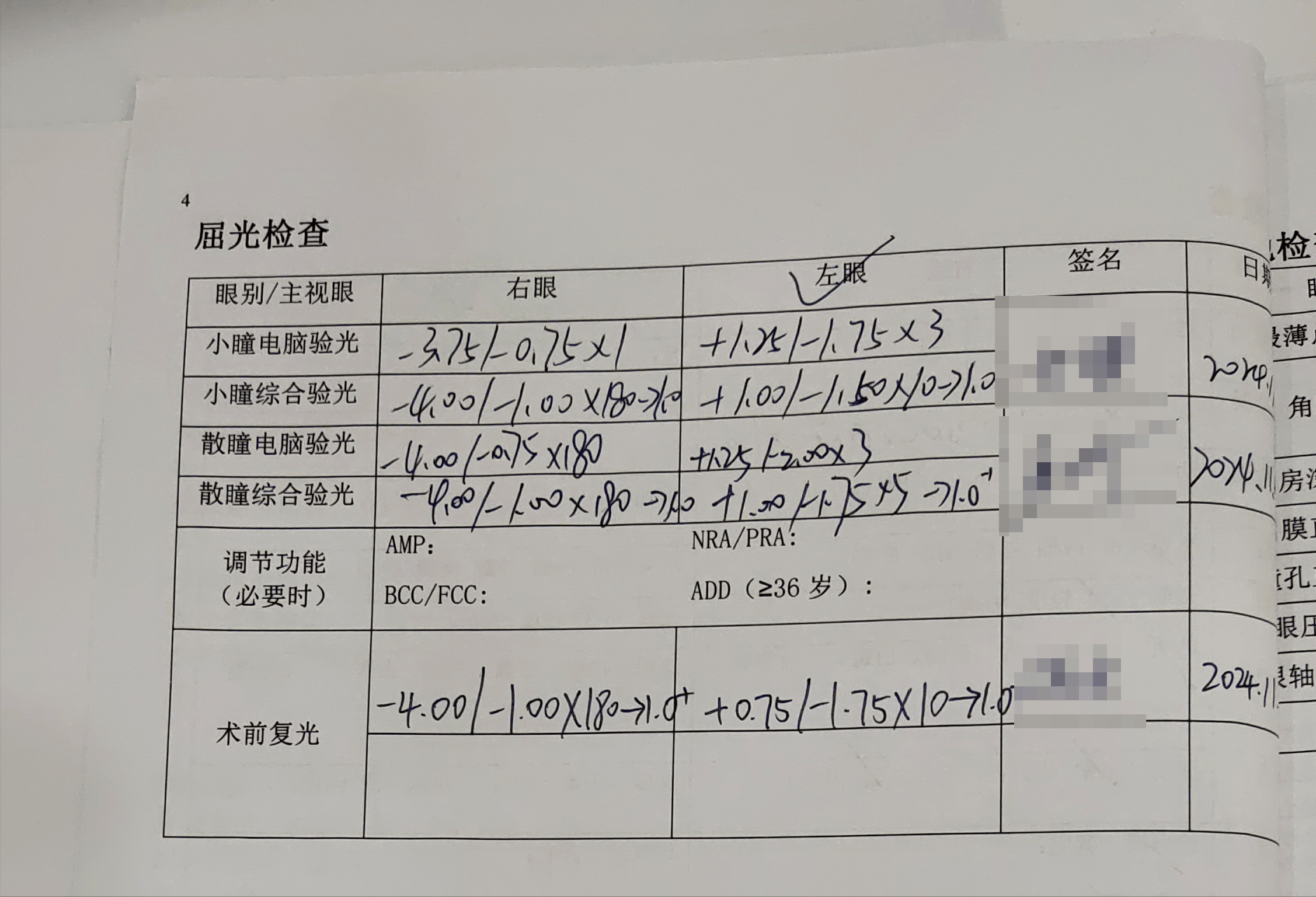 单眼近视400度在无锡华厦眼科做近视手术,术后视力1.0!