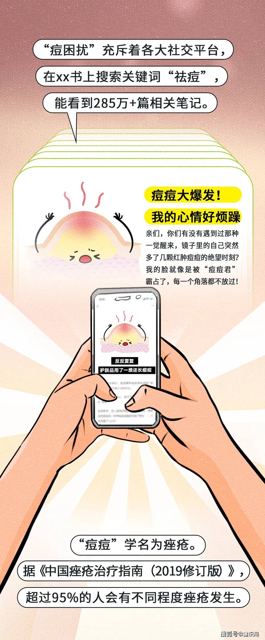 痤疮的形成受多种因素影响,比如角质细胞过度增殖,皮脂腺分泌过多