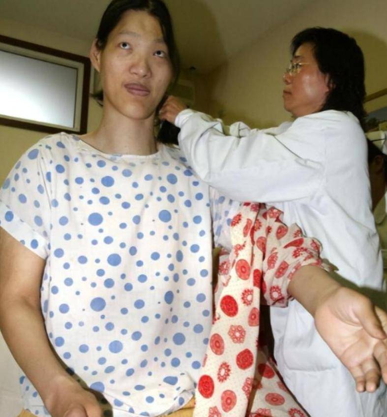 世界第一女巨人:比姚明高14cm,穿78码鞋,每天吃两斤米