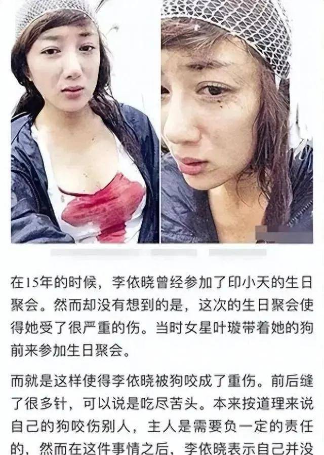 她曾是古装第一美人,被狗咬毁容后,如今41岁靠演坏女人翻身