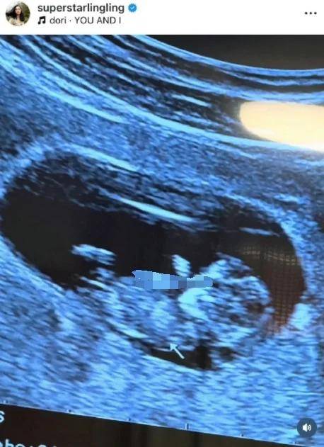 "欧雅若"扮演者洪小铃官宣结婚 晒b超照透露怀孕喜讯