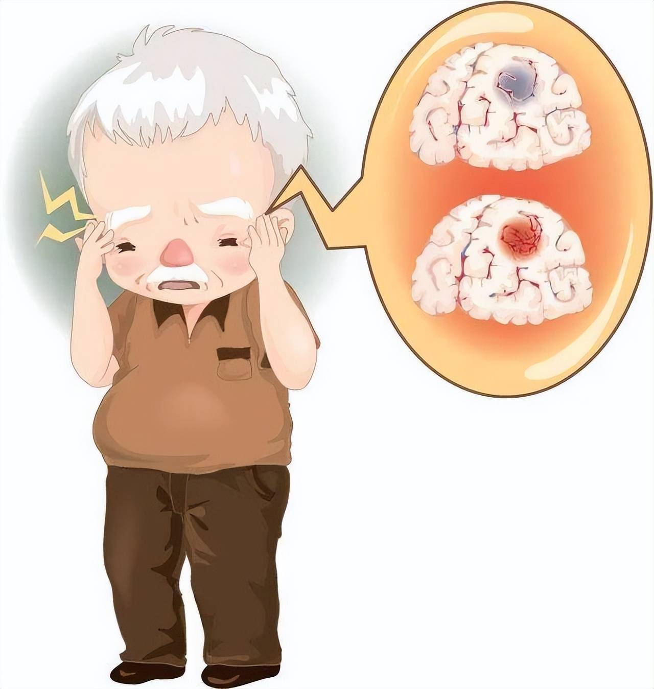 脑卒中后康复别忽视!重庆仁品医院：三大作用关乎患者尊严