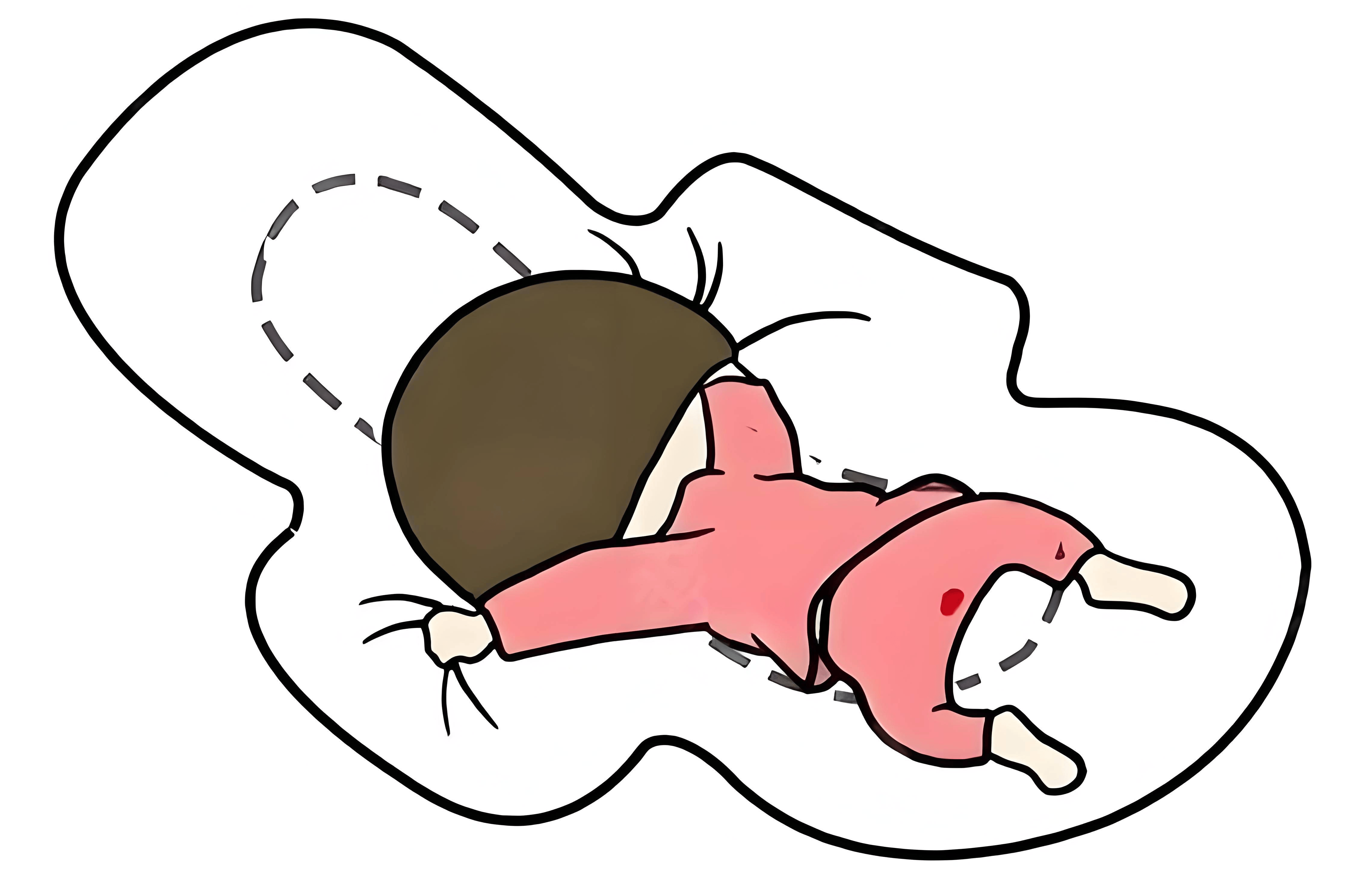 经期_颜色_液体