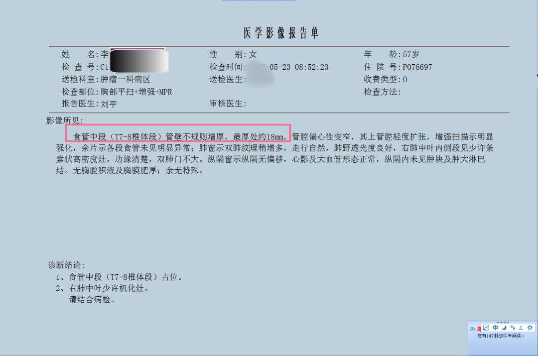 食管癌不开刀如何"大瘤化小,小瘤化了"?
