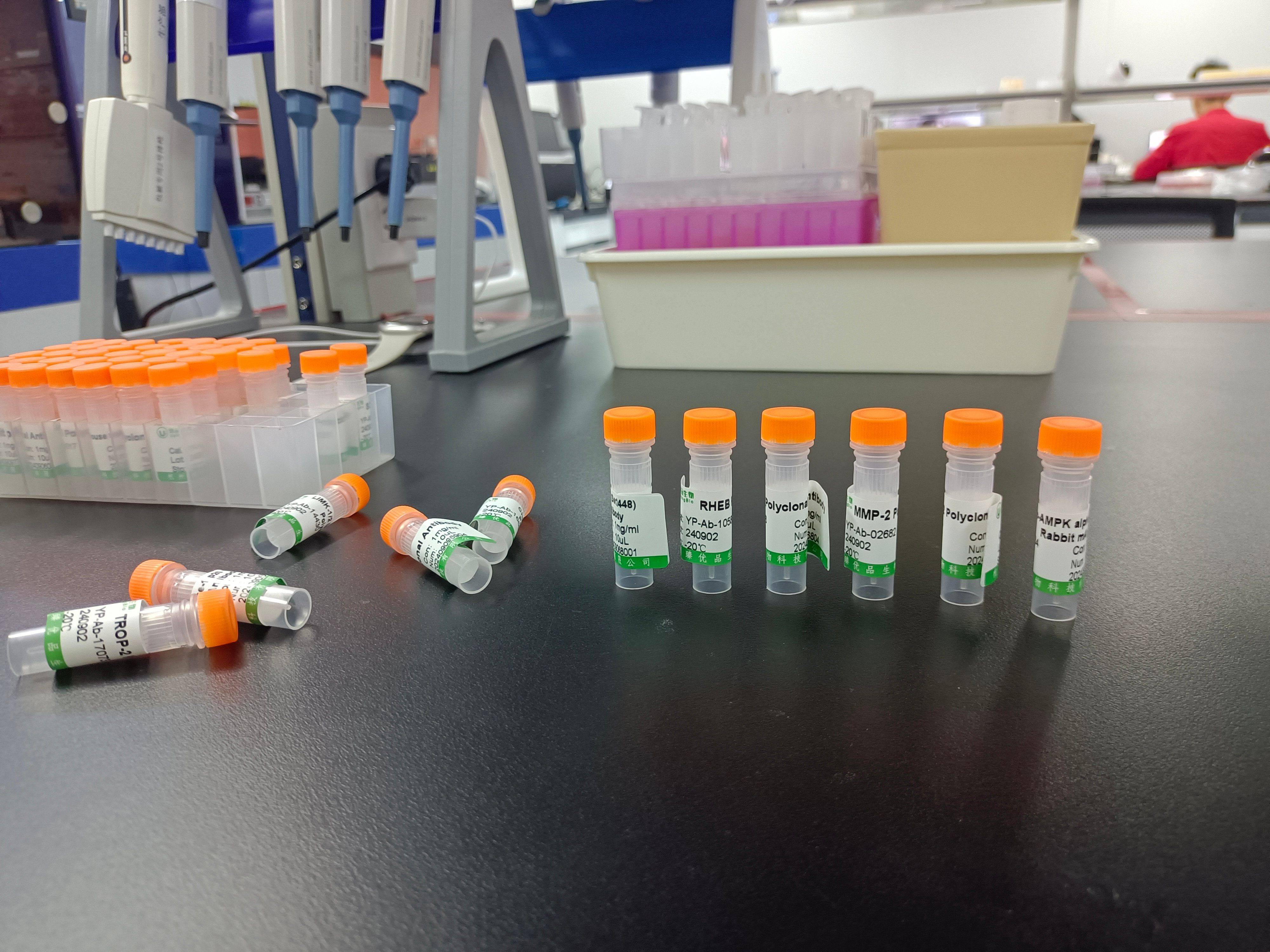 优质选择,精准检测:优品生物小鼠抗双链dna抗体检测试剂盒