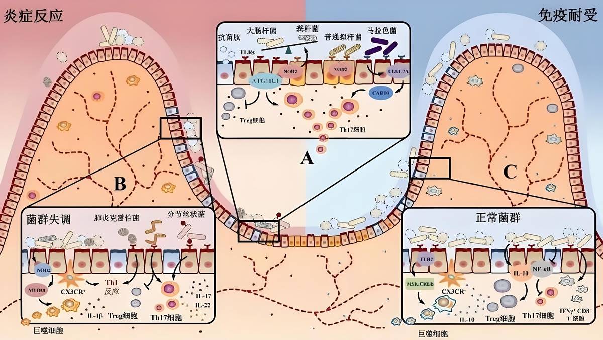 肠道菌群:身体炎症的自然调节师!_反应_移植_微生物