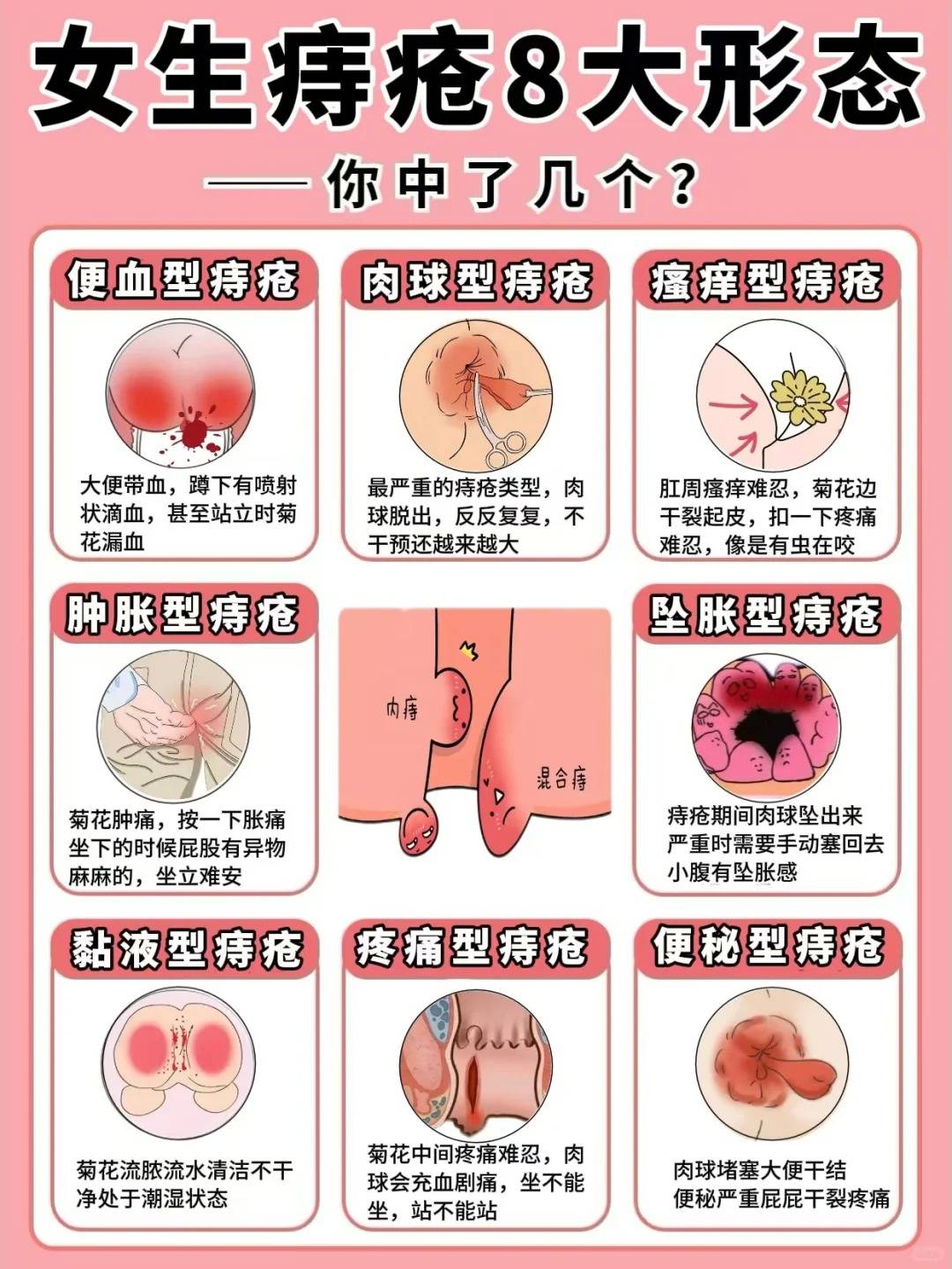 坚持8个动作,痔疮从此说再见!