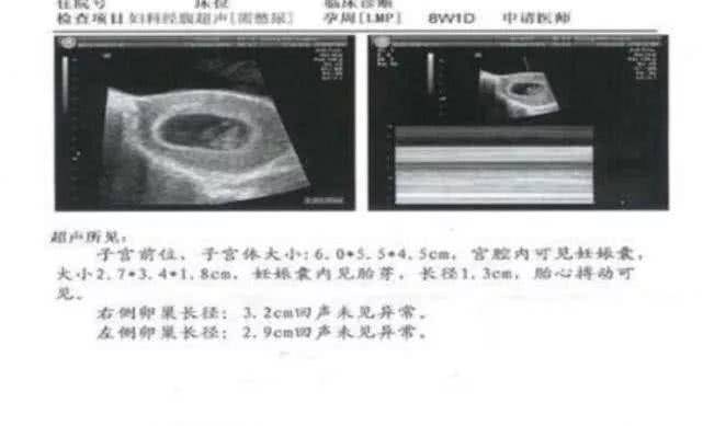 12周男胎儿b超图图片