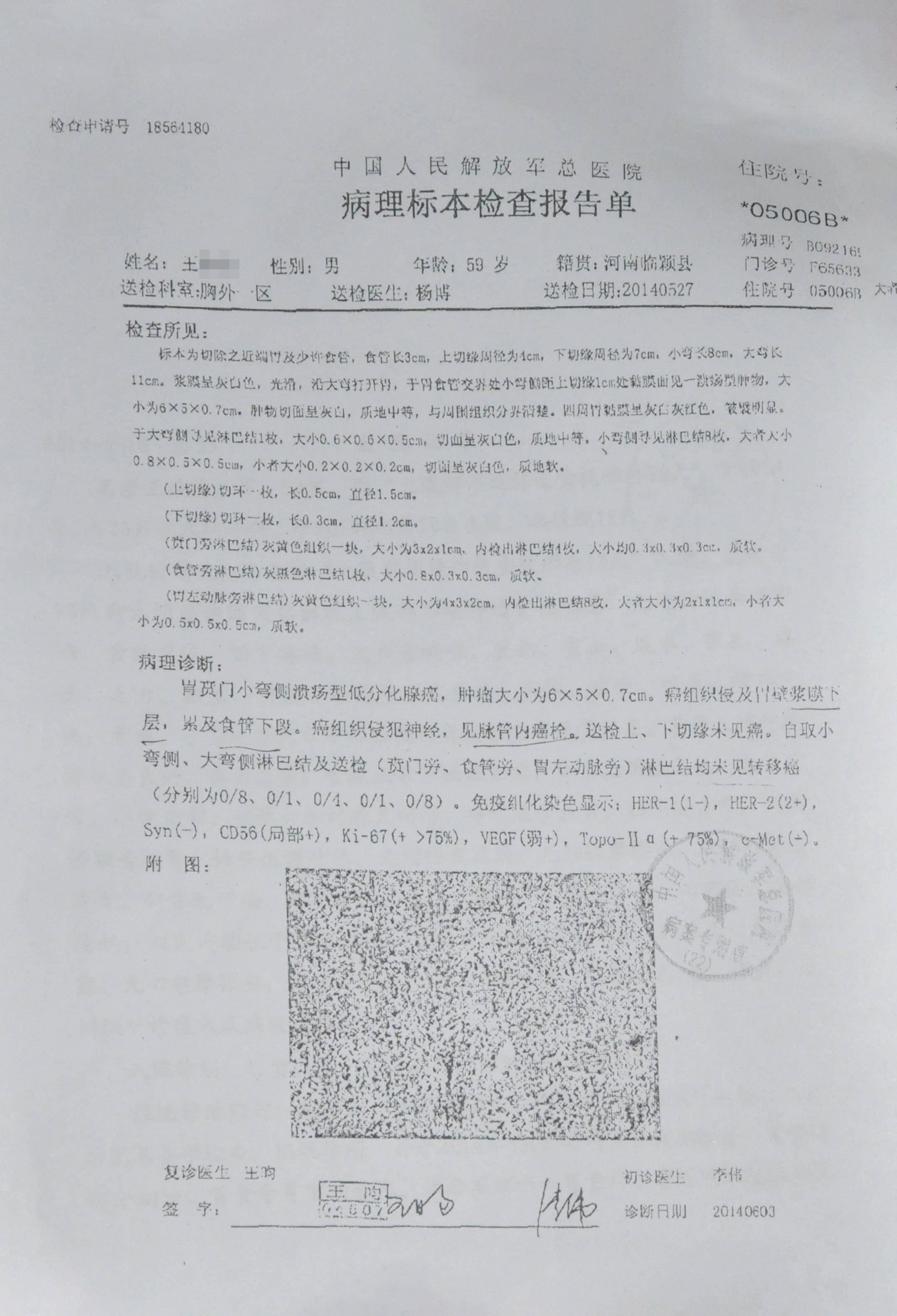 胃贲门癌十年抗争,如今的状态可真是好!