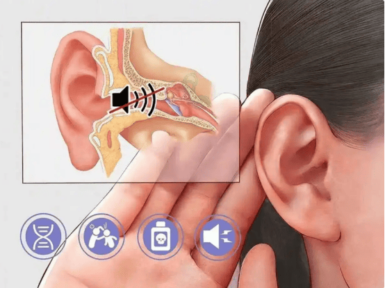 十大开放式耳机排行榜2025！热门开放式耳机品牌排行榜口碑对比