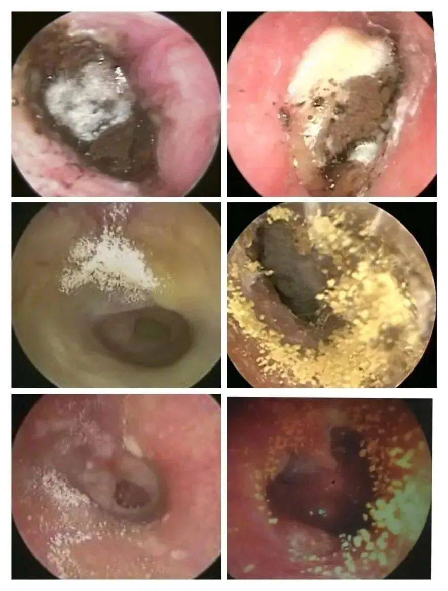 小心耳朵"发霉"