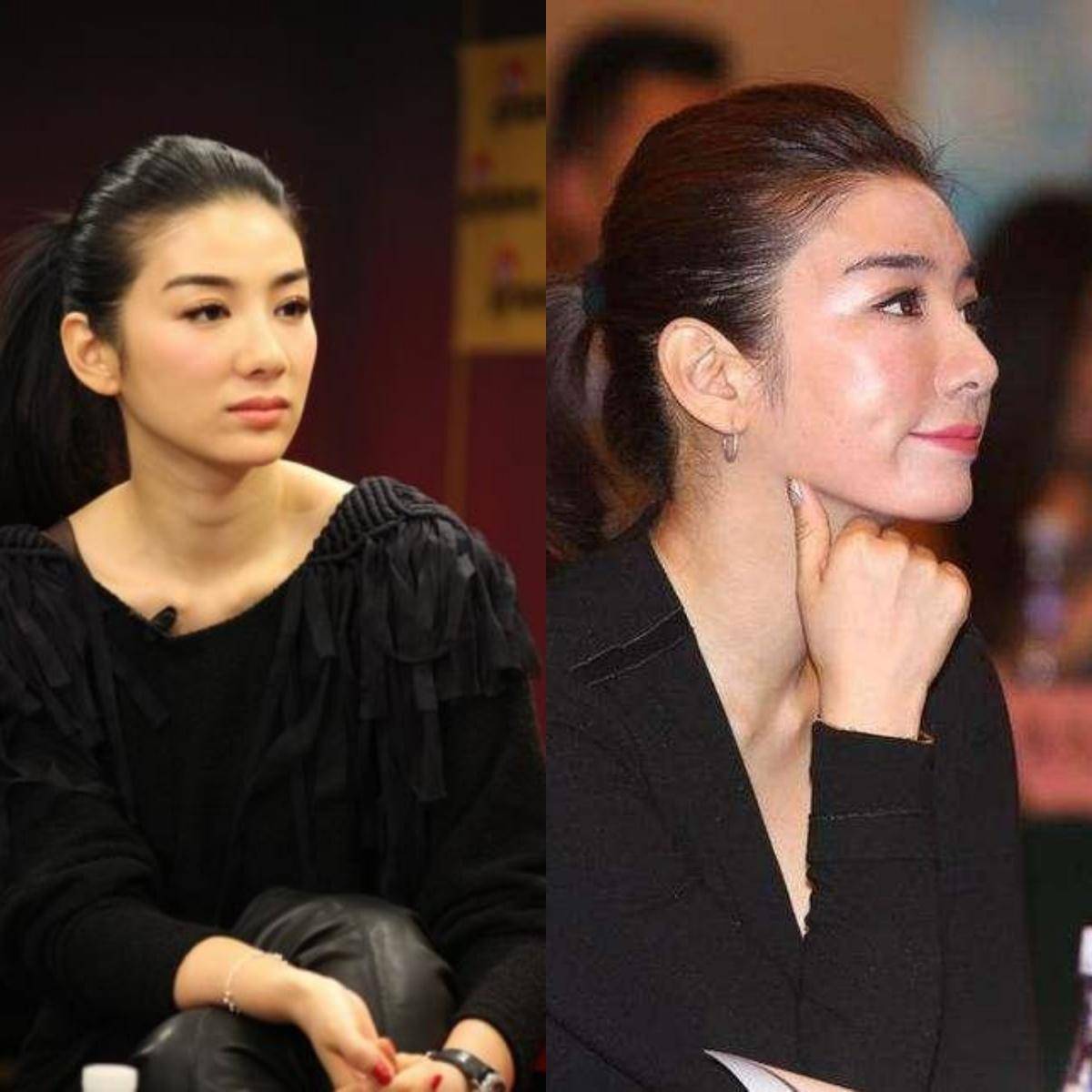 对比黄奕年纪大了又为了追求少女感,让自己的面部组织丰盈像少女,有点