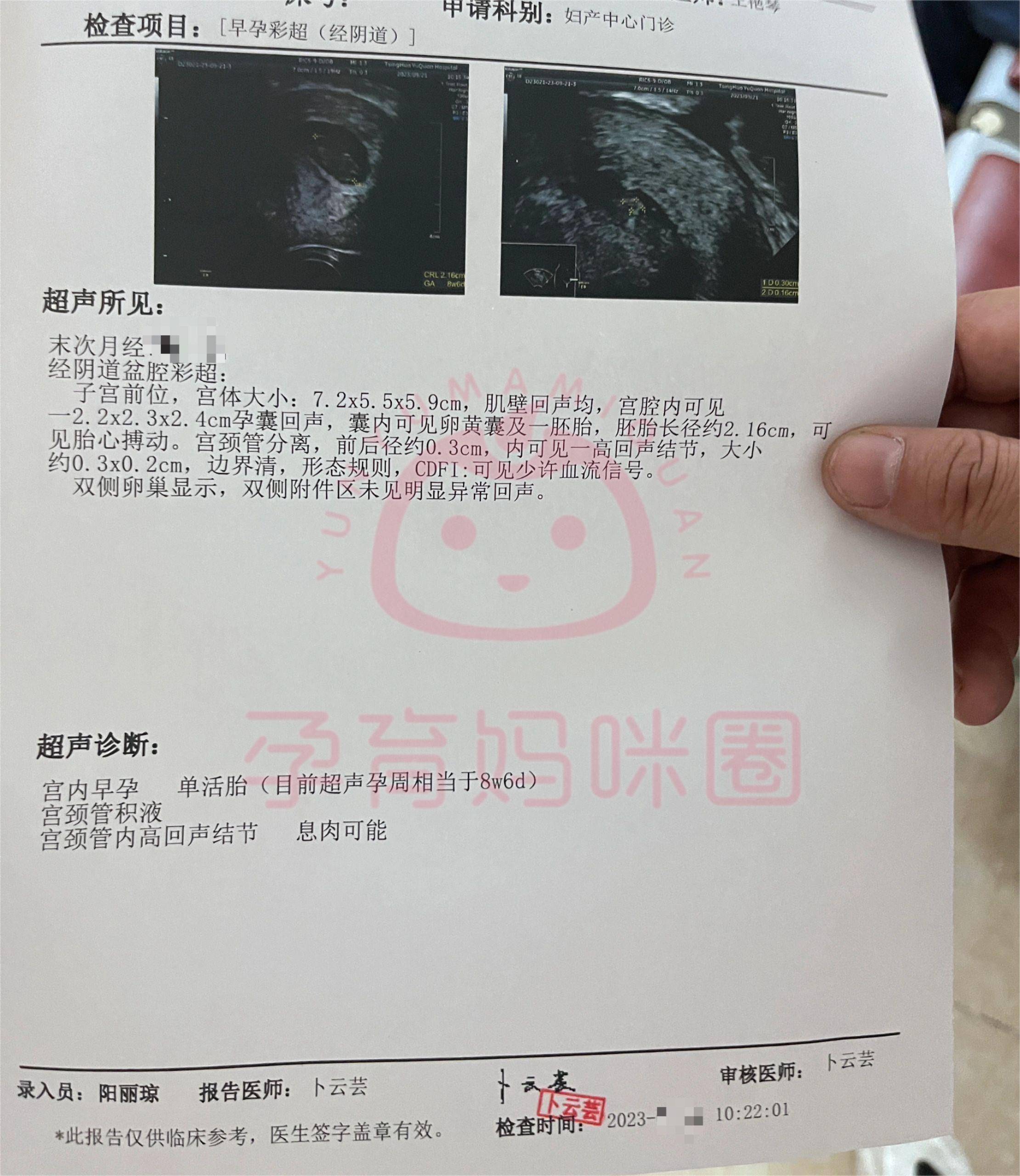 在预约的时间做nt检查,带齐所有资料和化验单,到产科正式办理建档.4