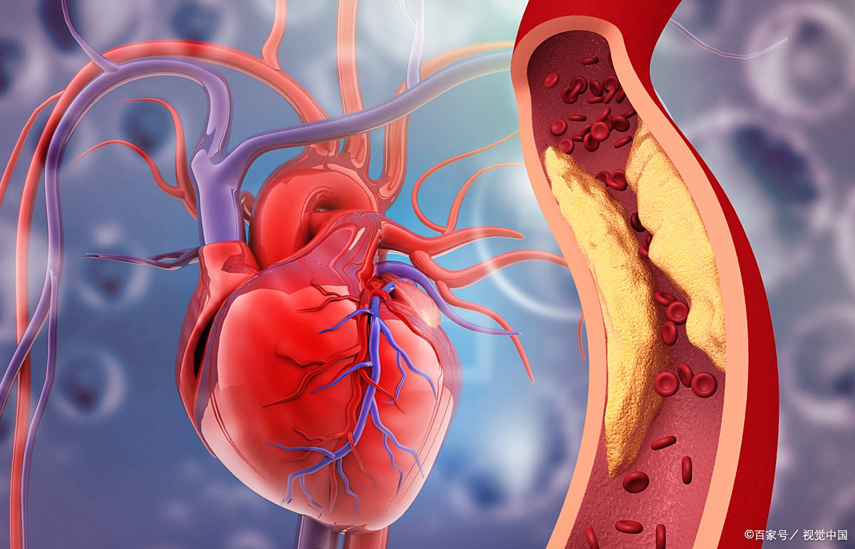 鹰演设备做的体检能检测出心脑血管疾病风险吗?