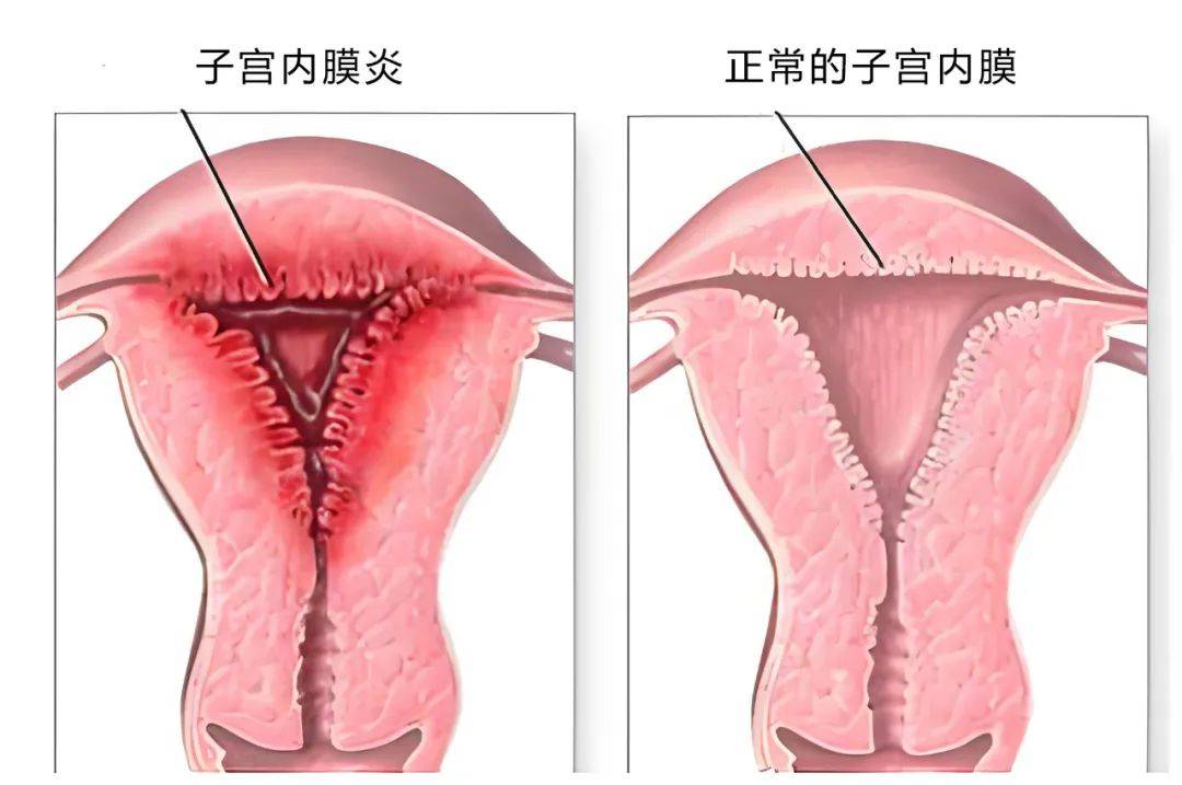 南京长江子宫研究苑提醒这些信号千万别忽视
