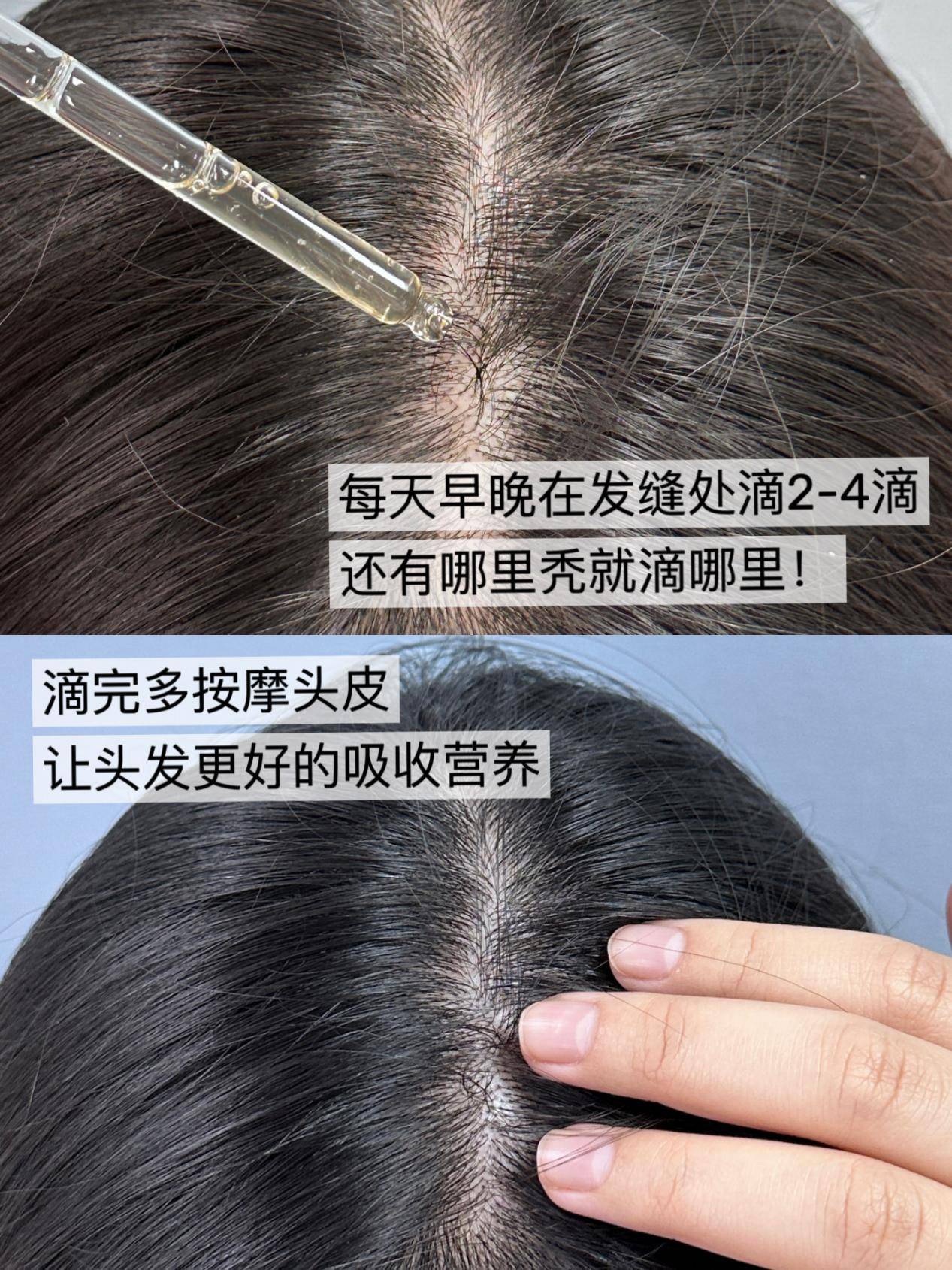 生发育发最有效的十大产品排名国药唯一承认的防脱生发液锁定发根