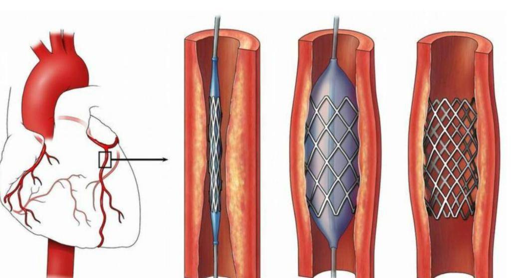 医生实话实说:支撑生命的是五点认知