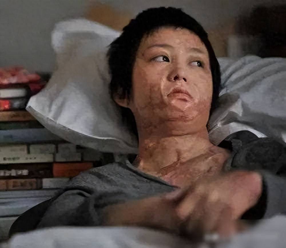 原创12年过去了拒绝同学求爱被泼汽油毁容的周岩现在怎么样了