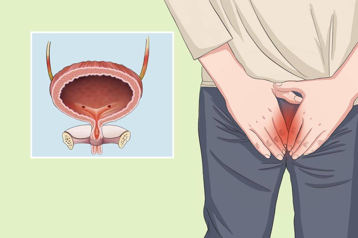 患膀胱疾病要注意啥?医生提醒这4件事别做,助你守护膀胱健康