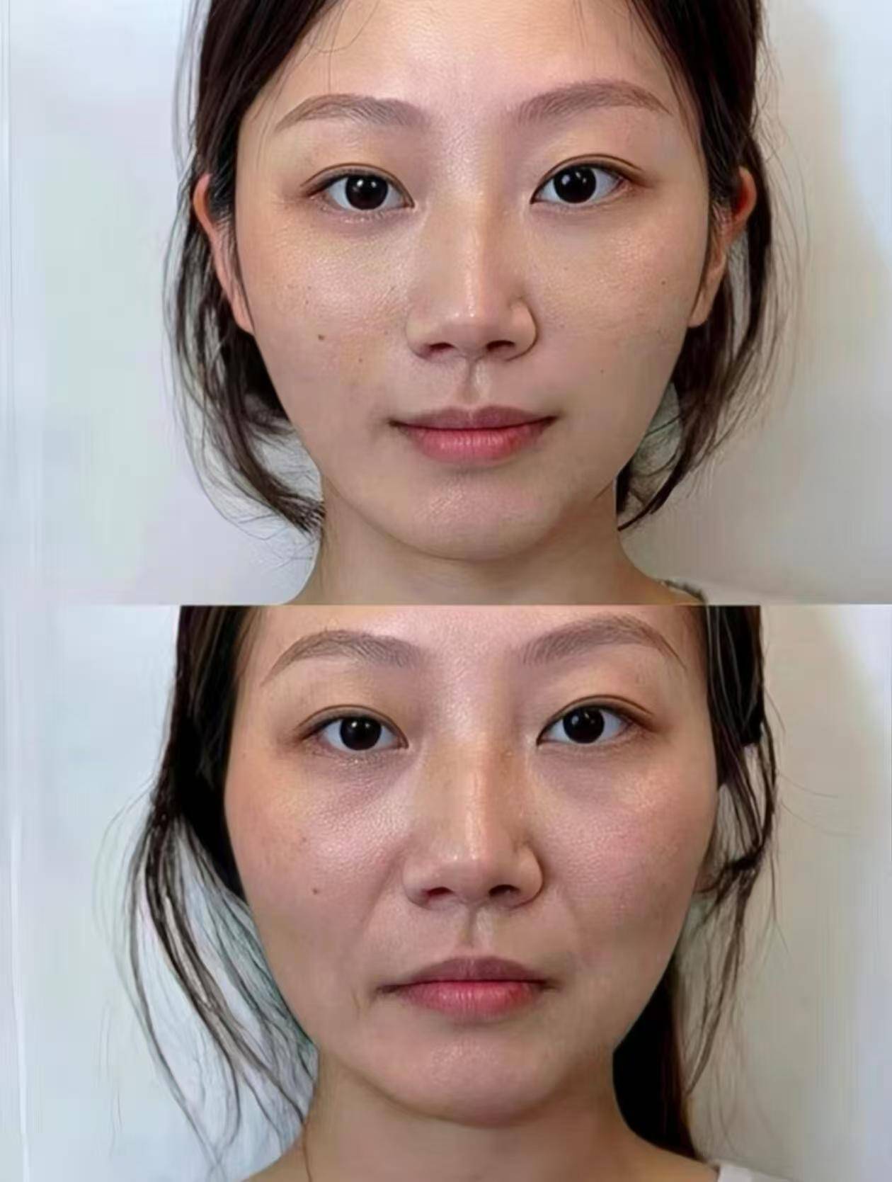 抗皱好的护肤品,抗皱效果好的护肤品分享,去皱化妆品前十名