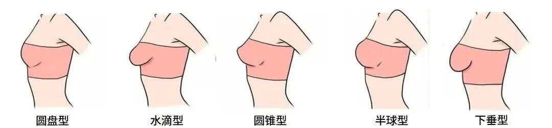 如何分辨真胸和假胸？隆的和真的一眼分辨