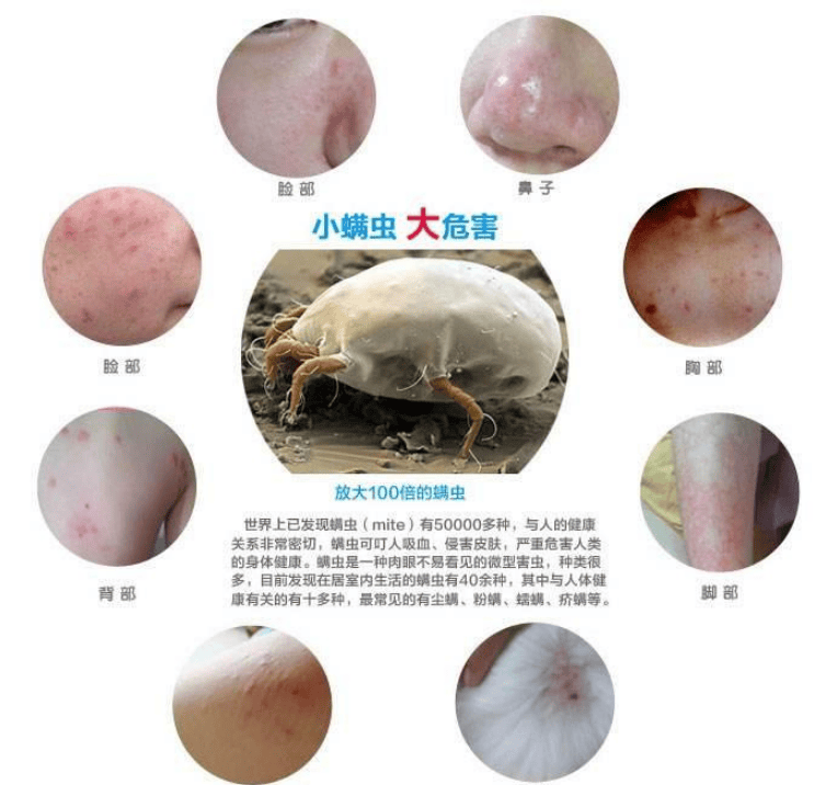 除螨仪什么牌子的好用?十大热门家用除螨仪品牌实测全解析