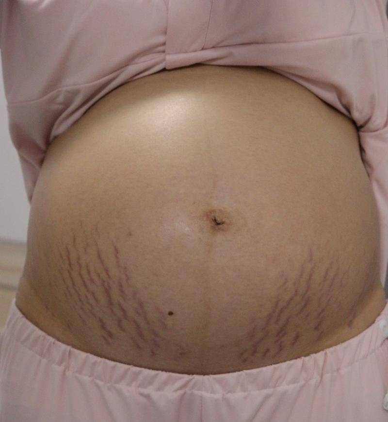 月子要坐多少天？医生：因人而异！少则42天,多则100天