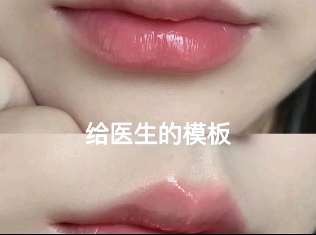 太原丽都整形被曝当面拆封:转身减量 求美者直呼被当傻子(图10)