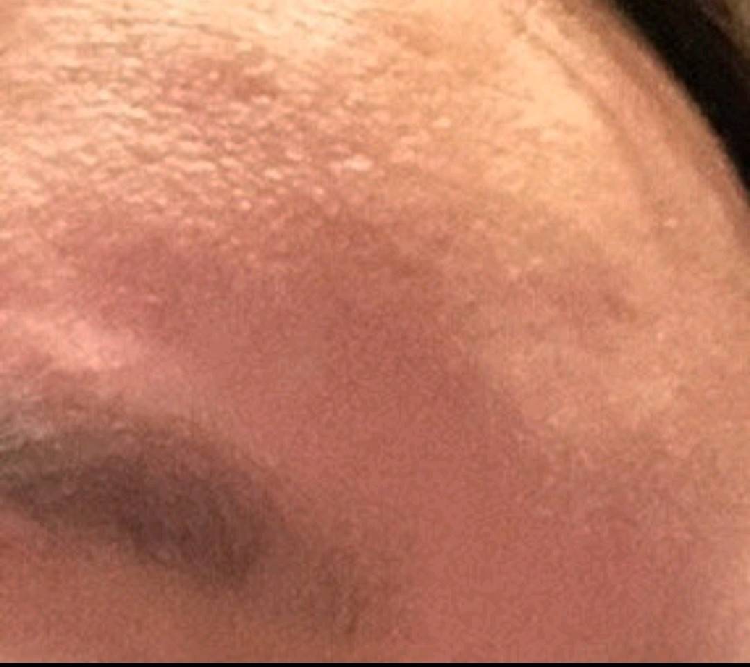 太原丽都整形被曝当面拆封:转身减量 求美者直呼被当傻子(图7)