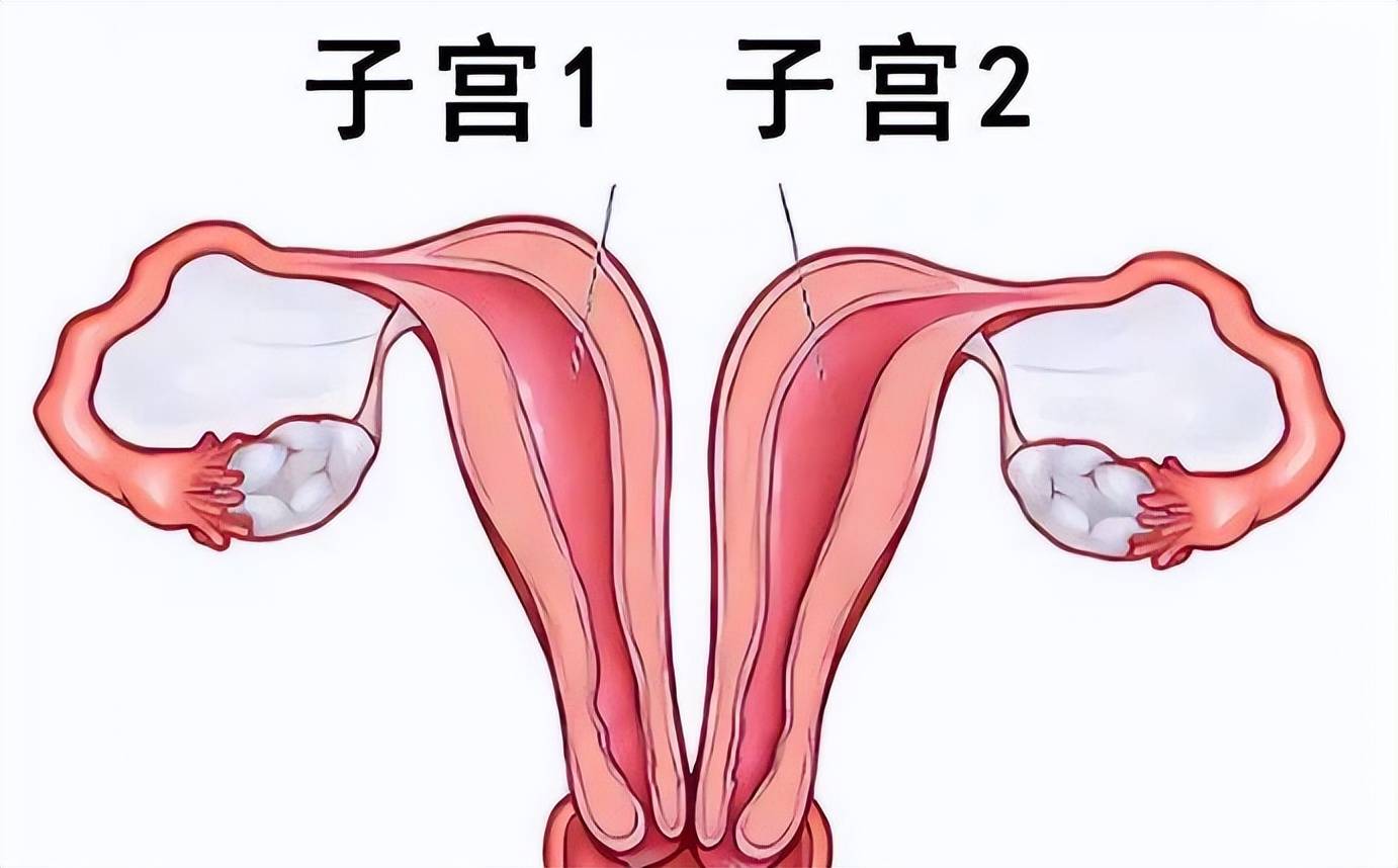 产妇生儿子刚出月子肚子疼半天又生女儿,医生：不算龙凤胎