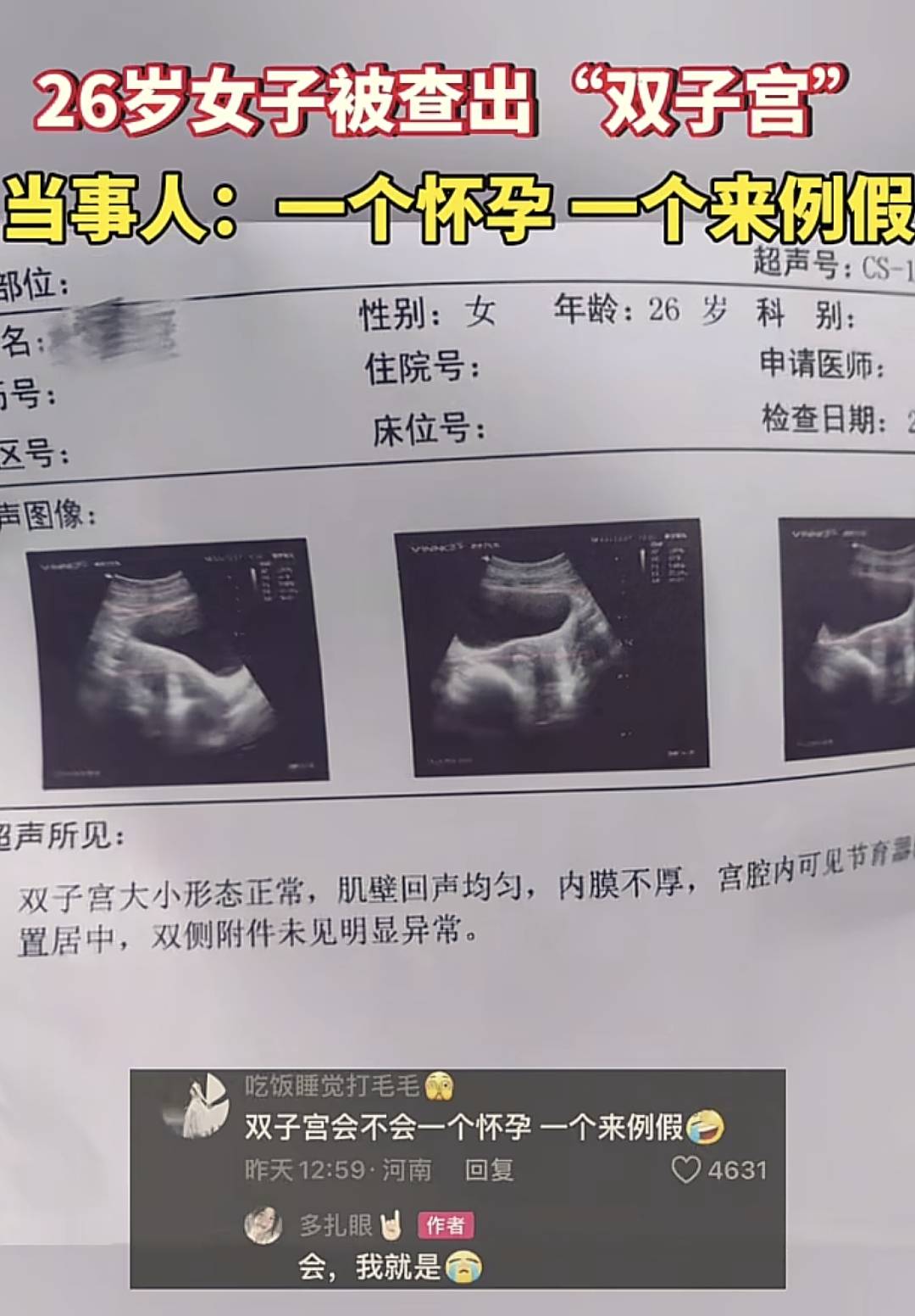 产妇生儿子刚出月子肚子疼半天又生女儿,医生：不算龙凤胎