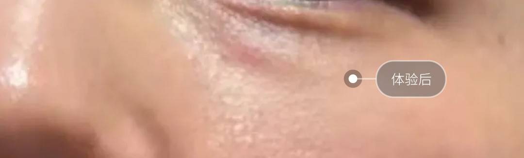 从行政处罚到消费者投诉 杭州联合丽格第六医美口碑聚焦(图12)