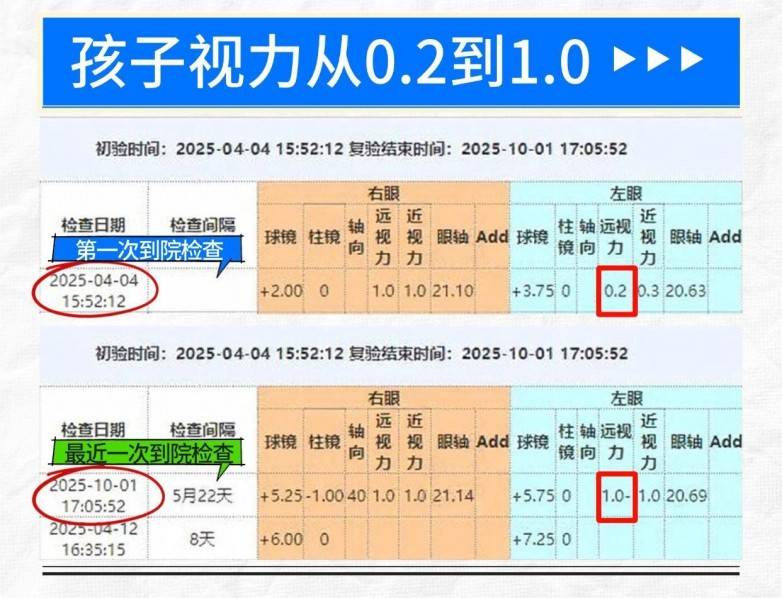 专业铸就光明，佛山爱尔眼科视功能训练助7岁女孩视力从0.2跃升至1.0(图3)