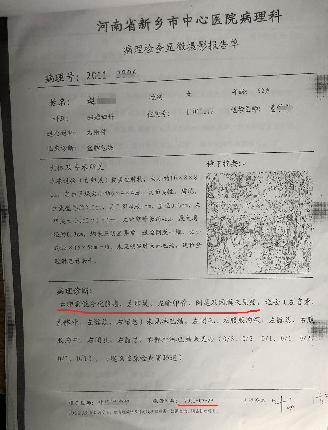卵巢癌的她尝试中药已经15年了