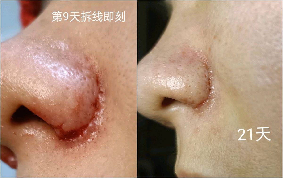 get?code=YThlMTE0NDM0MzU0NDdiYmI2ZmEyMWEyNGMzODE5NWYsMTc3NTE5ODcyMDk0MA==