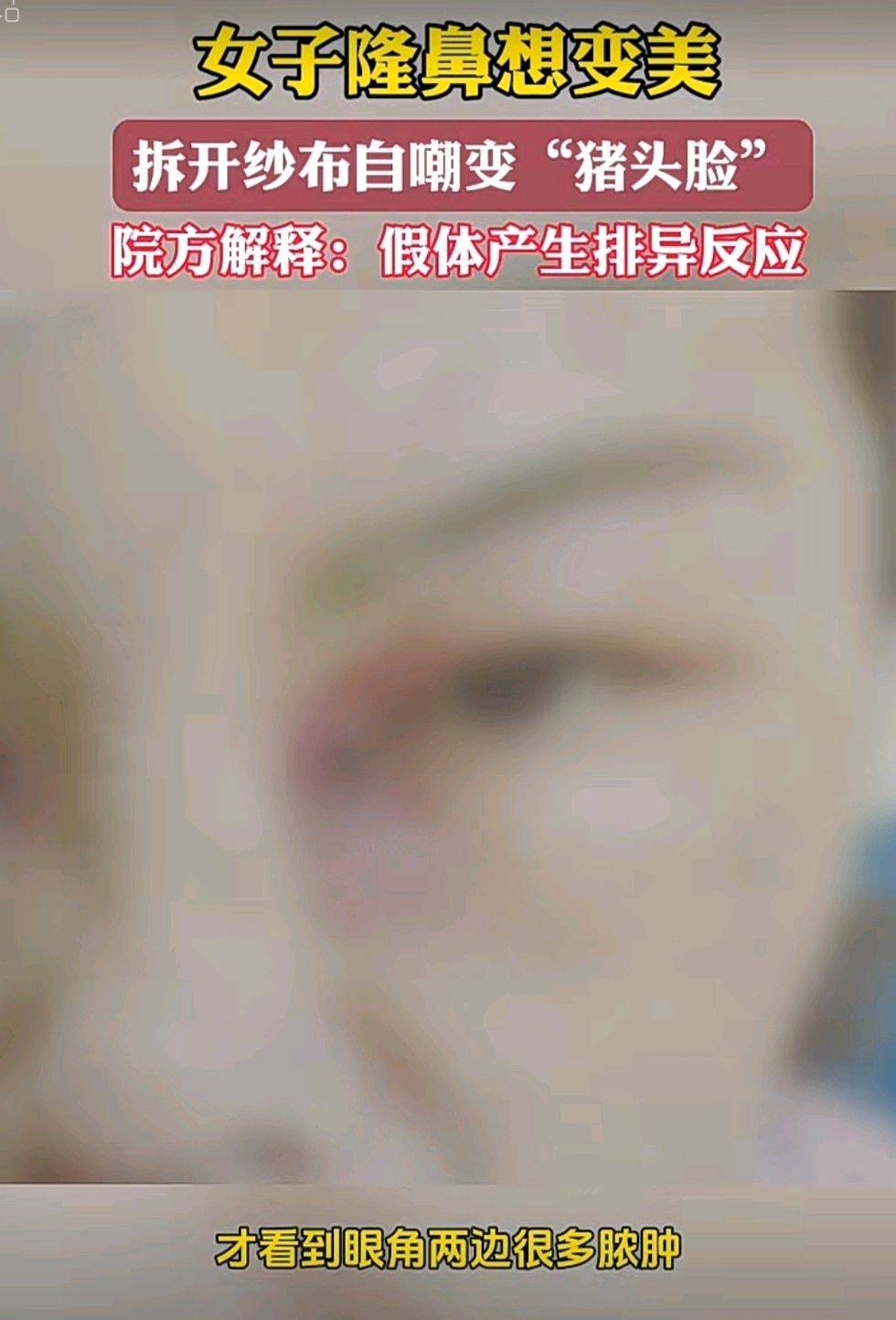 get?code=YTlmYTZkMmMxOGYyNWI0YWY5M2ViYzI3Nzg5MDMyYWMsMTc3NTQ2MTQ1NzM1OQ==