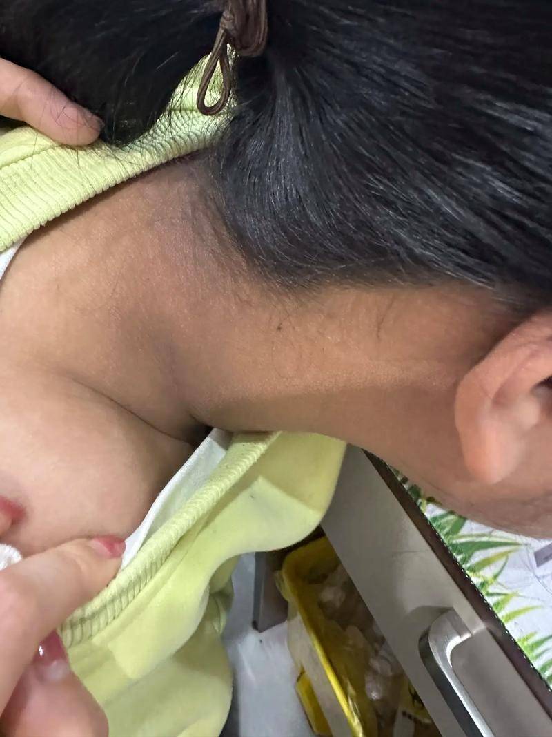 孩子身上出现三种“不搭”的胖,请尽快就医
