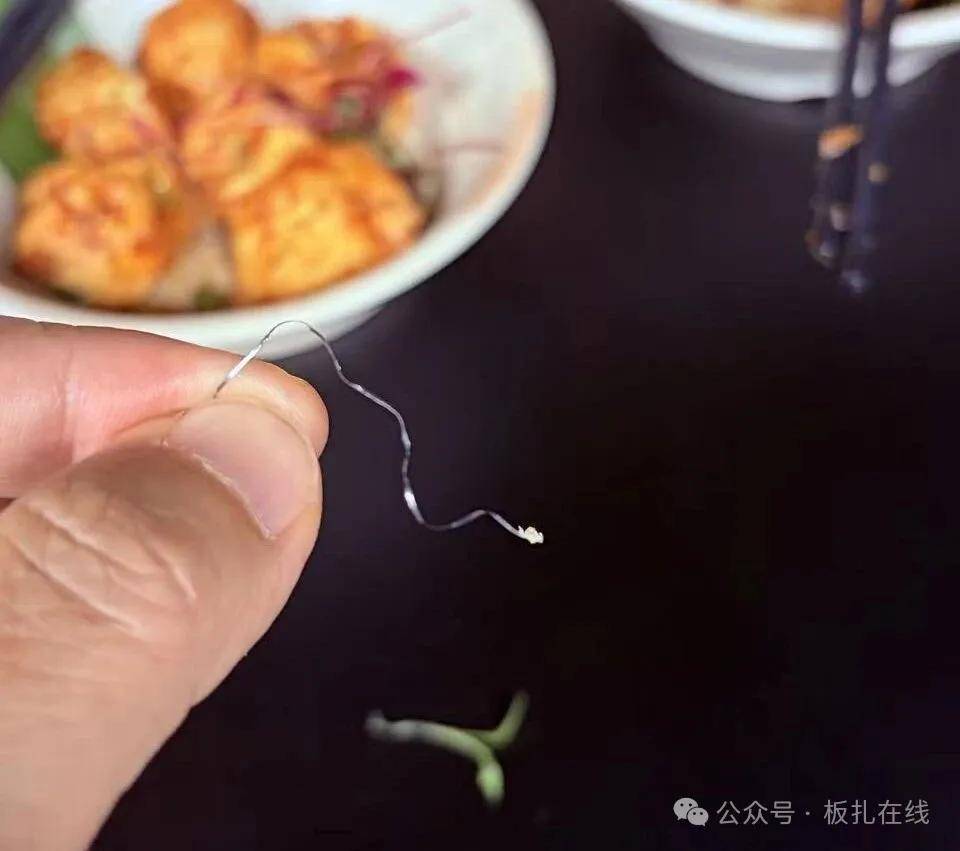 男子称在玖合素手多次吃出钢丝 不慎吃进肚