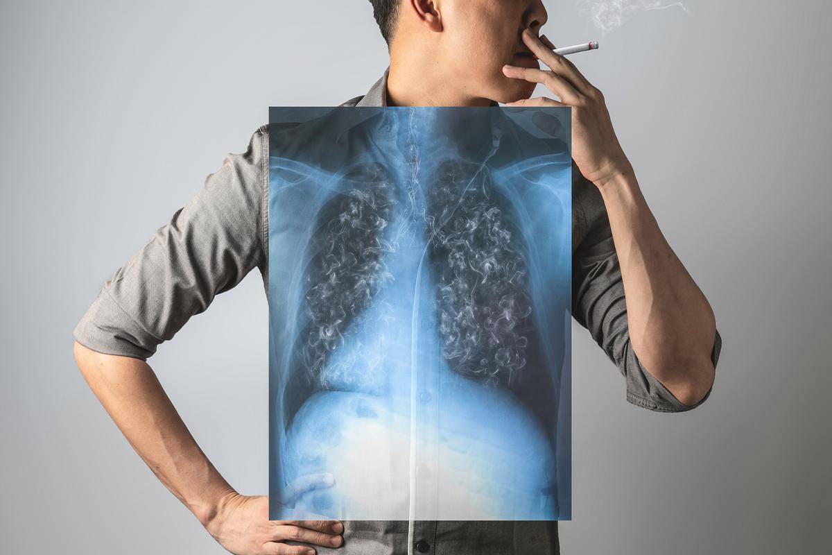 原创            呼吸科医生：只要低密度脂蛋白不超这个值，肺癌风险就不用太焦虑