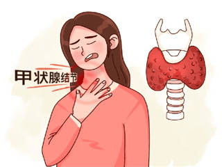 甲状腺乳头状癌：早期几乎不痛不痒！出现这几个信号，别当成普通结节