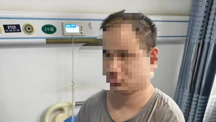 盲人体验小米汽车导致手指骨折，小米应该赔偿吗？