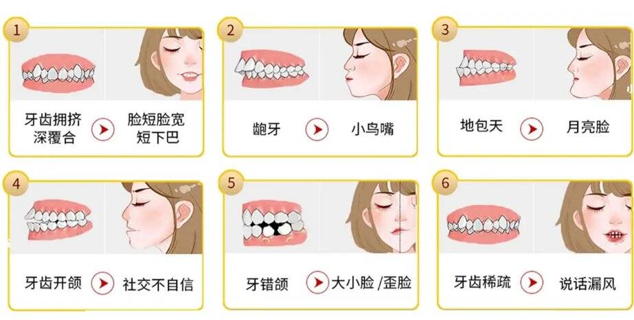 孩子牙齒不好看需要矯正嗎?選哪種矯治器合適?_進行